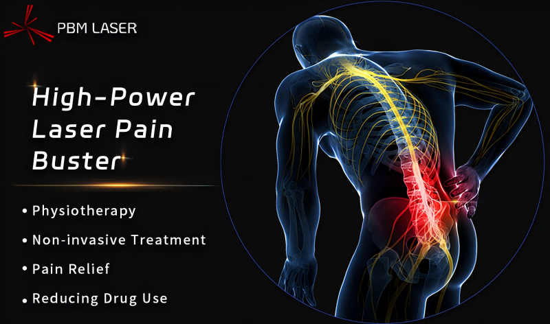 PBM Medical Laser 丨 A rehabilitációs kód feloldása, a nagy teljesítményű lézer A fokozatú ajánlást kapott a kínai krónikus derékfájás diagnosztizálására és kezelésére vonatkozó irányelvekben (2024-es kiadás)